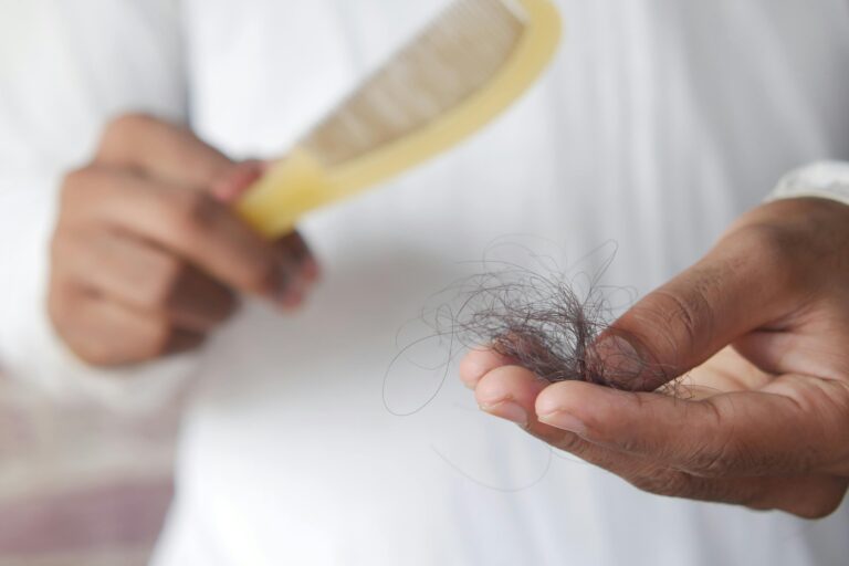 A detailed image showing hair loss with a comb in hand, symbolizing alopecia and related issues.